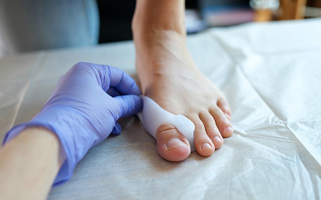 Hallux valgus - eine frühe Behandlung erspart Schmerzen und Stress